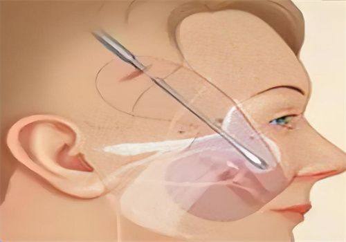 武汉芯动医疗美容门诊部收费价格表/收费标准