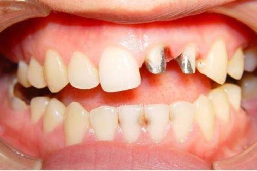 大理雅美口腔门诊部特色项目及技术优势