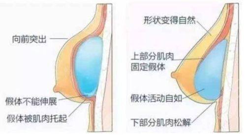 祖开慧医生技术优势