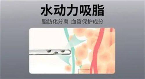 邵小晓医生技术优势