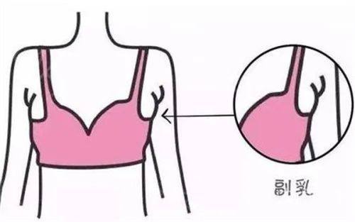 祖开慧医生口碑评价及真人实例