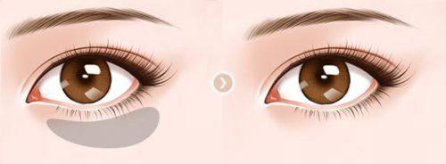 倪绚医生口碑评价及真人实例