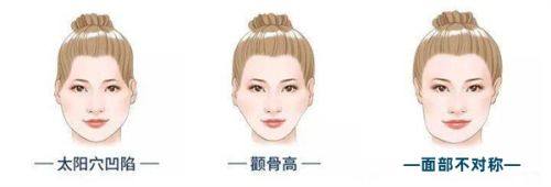 石红卫医生口碑评价及真人实例