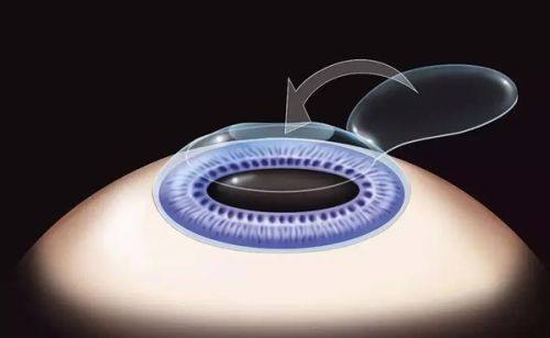 赵博军 医生技术优势