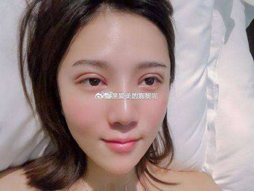 兰州恩喜医学美容医院详细的预约挂号方式及流程