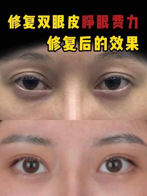 武汉芯动医疗美容门诊部是正规医院吗?