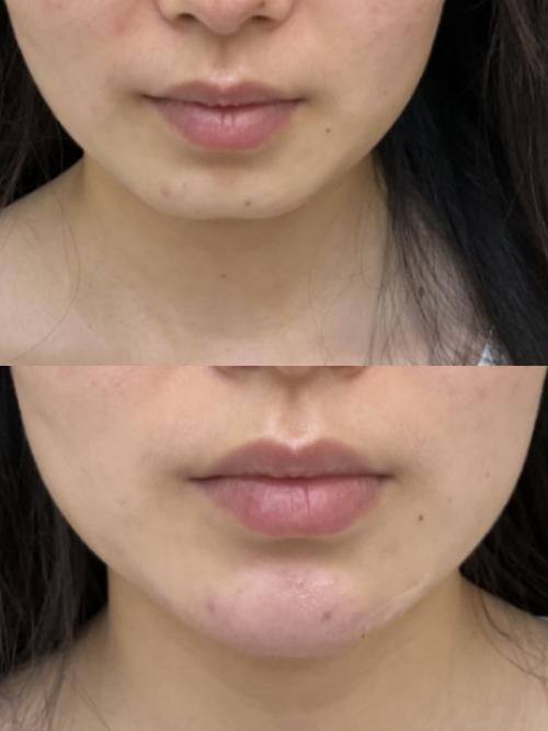 韩国Dr. Basic clinic收费价格表/收费标准