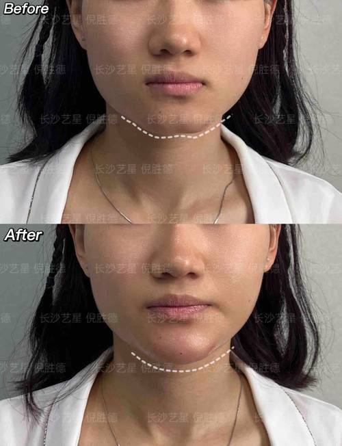 韩国Dr. Basic clinic真人口碑评价怎么样？