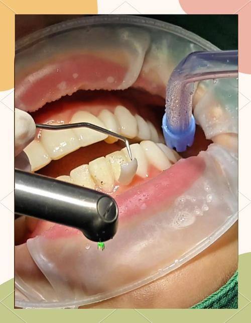 大理雅美口腔门诊部地址电话营业时间