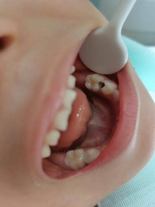 宁海丁伟口腔诊所地址电话营业时间