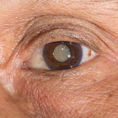 安徽医 科 大学附属阜阳医院眼科医生团队实力强大及骨干医生简介