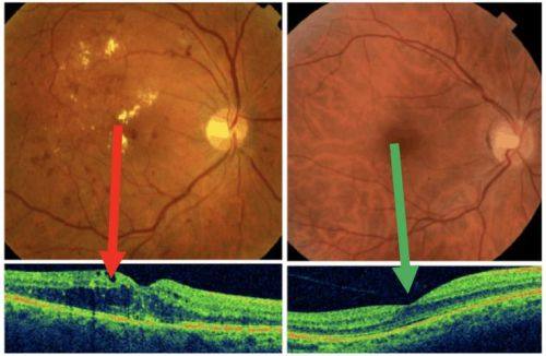 哈尔滨市阿城区人民医院眼科是正规医院吗？