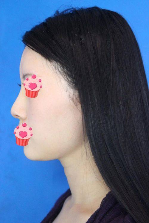 兰州恩喜医学美容医院特色项目及技术优势