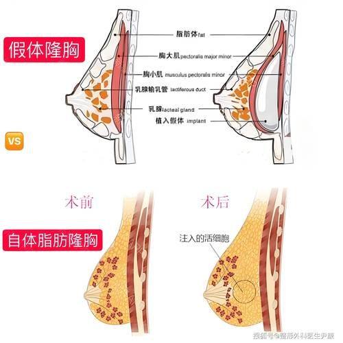 中山美尔医疗美容门诊部是正规医院吗？