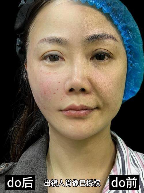 济南星范医疗美容诊所真人口碑评价怎么样？