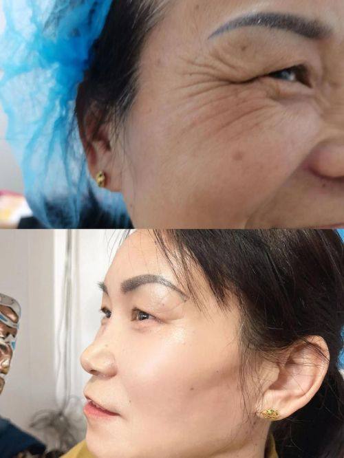 济南星范医疗美容诊所特色项目及技术优势