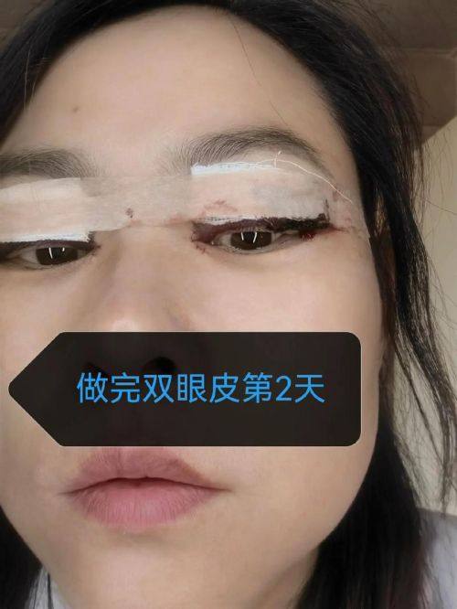 北京微丽整形医院真人口碑评价怎么样?