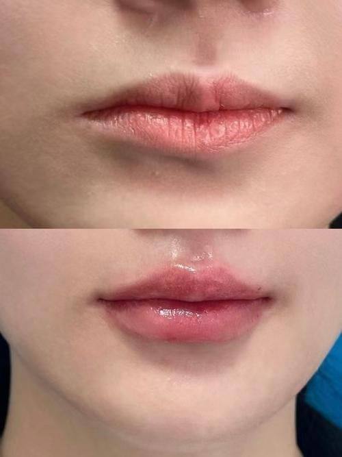 安顺李建明医疗美容诊所是正规医院吗？