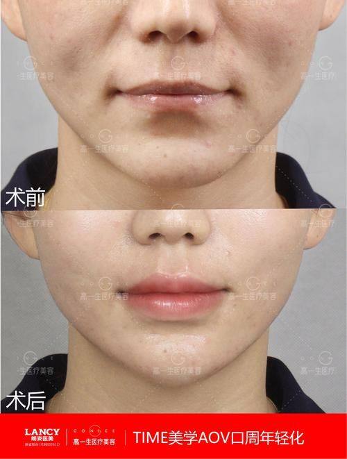 安顺李建明医疗美容诊所收费价格表/收费标准