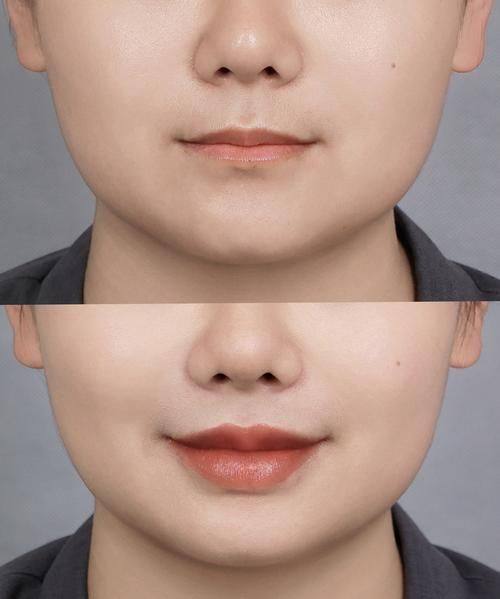 广州多美整形详细的预约挂号方式及流程