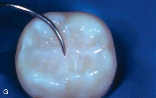 柳州陌客尔口腔诊所收费价格表/收费标准