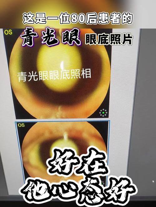 梧州市工人医院眼科真人口碑评价怎么样？