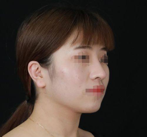 北京微丽整形医院特色项目及技术优势