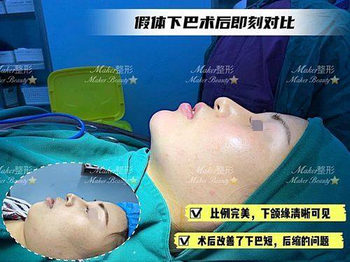 广州多美整形是正规医院吗？