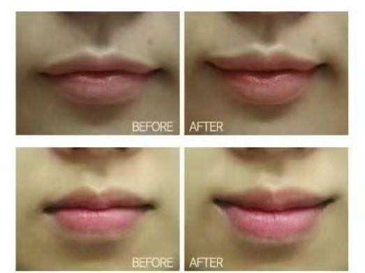 安顺李建明医疗美容诊所真人口碑评价怎么样？