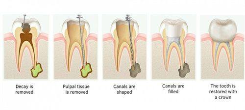 上海峰凡口腔特色项目及技术优势