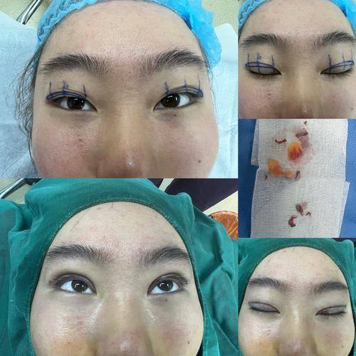 宁波市第二医院整形美容科详细的预约挂号方式及流程