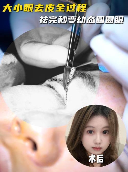 上海康丽整形外科医院收费价格表/收费标准