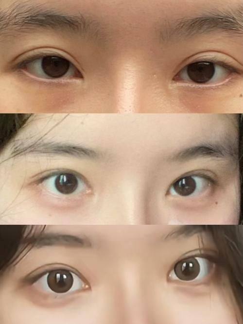 漯河苏美尔整形医院真人口碑评价怎么样？