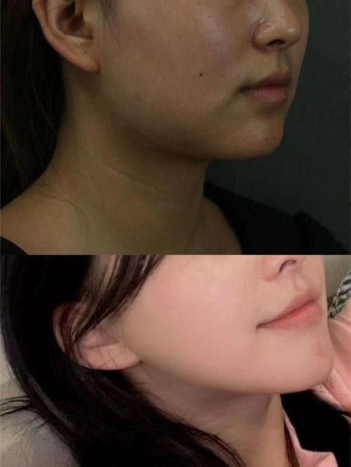 上海康丽整形外科医院特色项目及技术优势