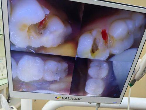 潍坊安丘王凤娟口腔诊所真人口碑评价怎么样？