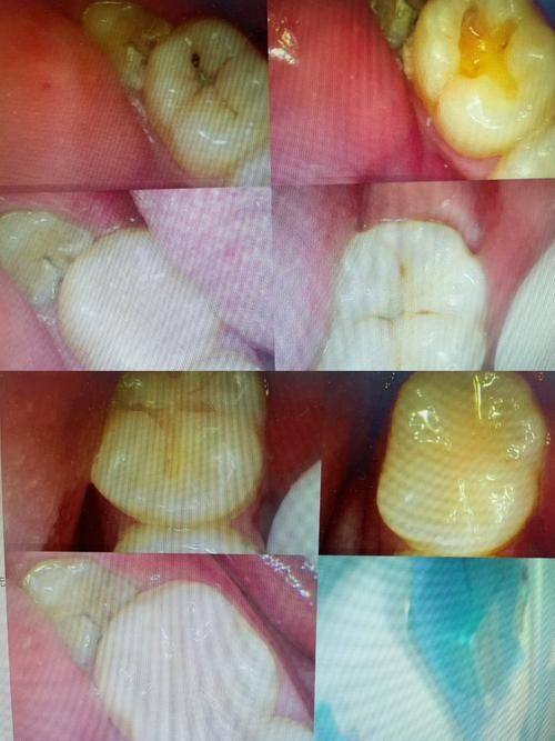 详细的预约挂号方式及流程