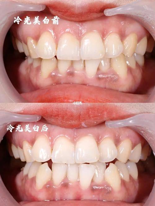 晋中恒伦口腔门诊部是正规医院吗？