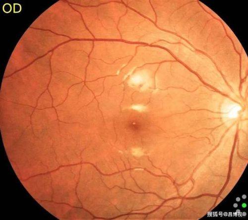 厦门市第五医院眼科医生团队实力强大及骨干医生简介