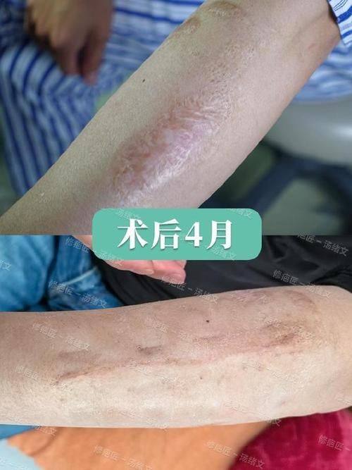 沭阳县孙宝厚整形医院真人口碑评价怎么样?