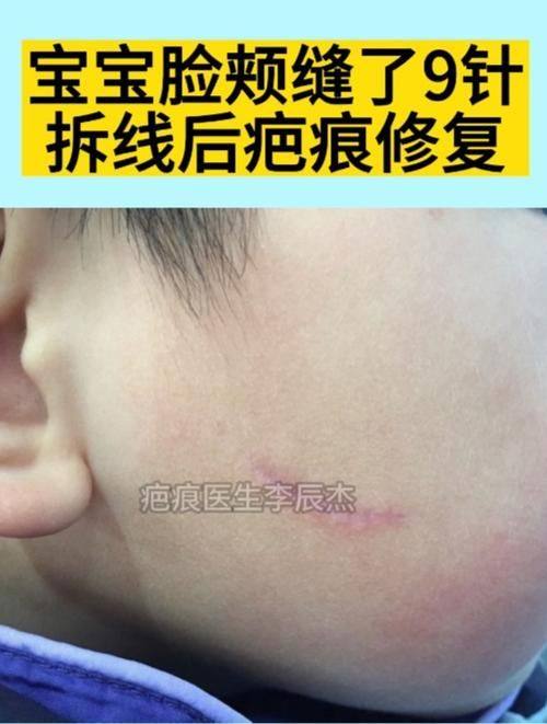 沭阳县孙宝厚整形医院地址电话营业时间