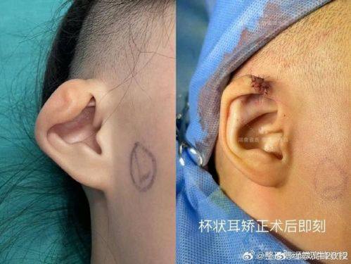 宁波市第二医院整形美容科简介概述