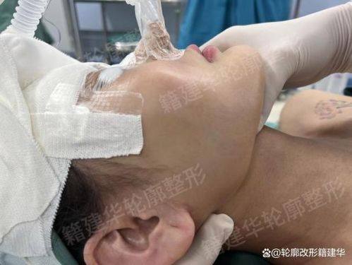 沭阳县孙宝厚整形医院是正规医院吗?