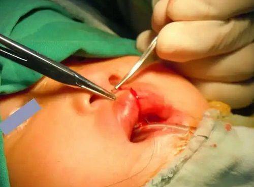 中山奢颜立整形医院真人口碑评价怎么样?