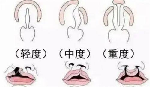 中山奢颜立整形医院收费价格表/收费标准