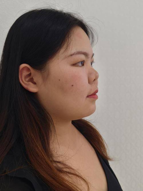 广州紫馨整形外科医院特色项目及技术优势