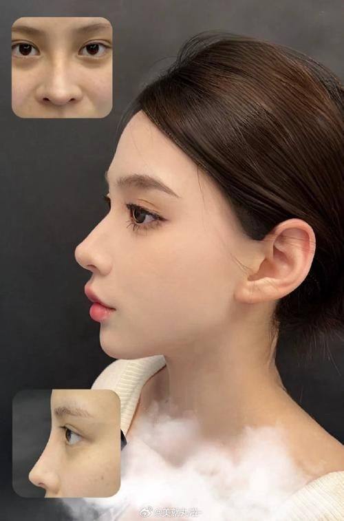 南京王猛整形医院是正规医院吗?