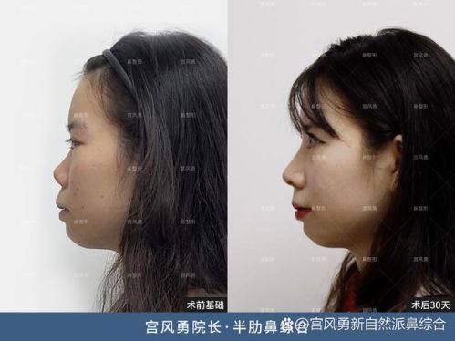 南京王猛整形医院特色项目及技术优势