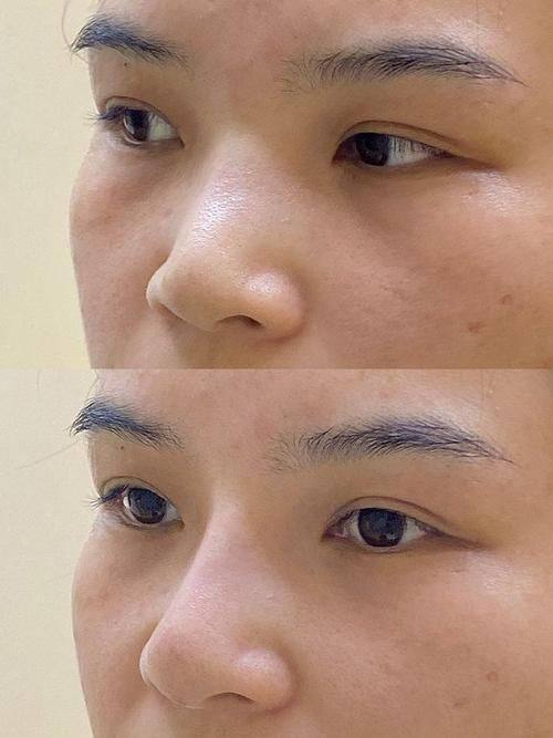 上海御美妍医疗美容门诊部特色项目及技术优势