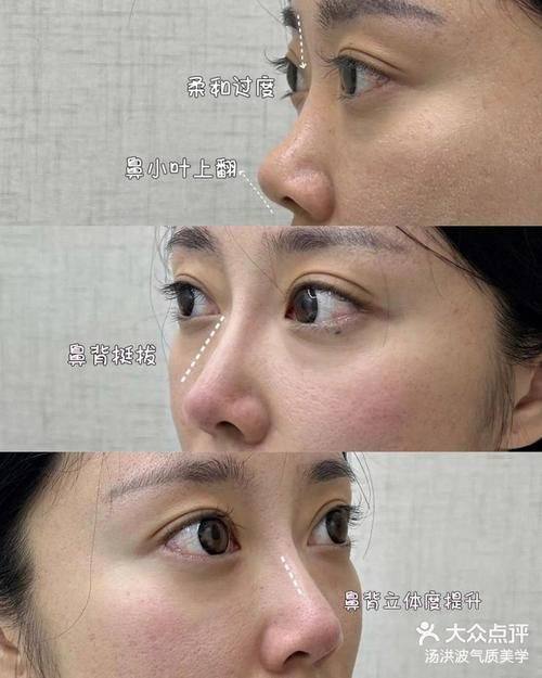 上海御美妍医疗美容门诊部真人口碑评价怎么样？