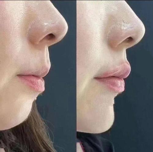 中山奢颜立整形医院地址电话营业时间